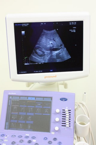 超音波検査機器の写真